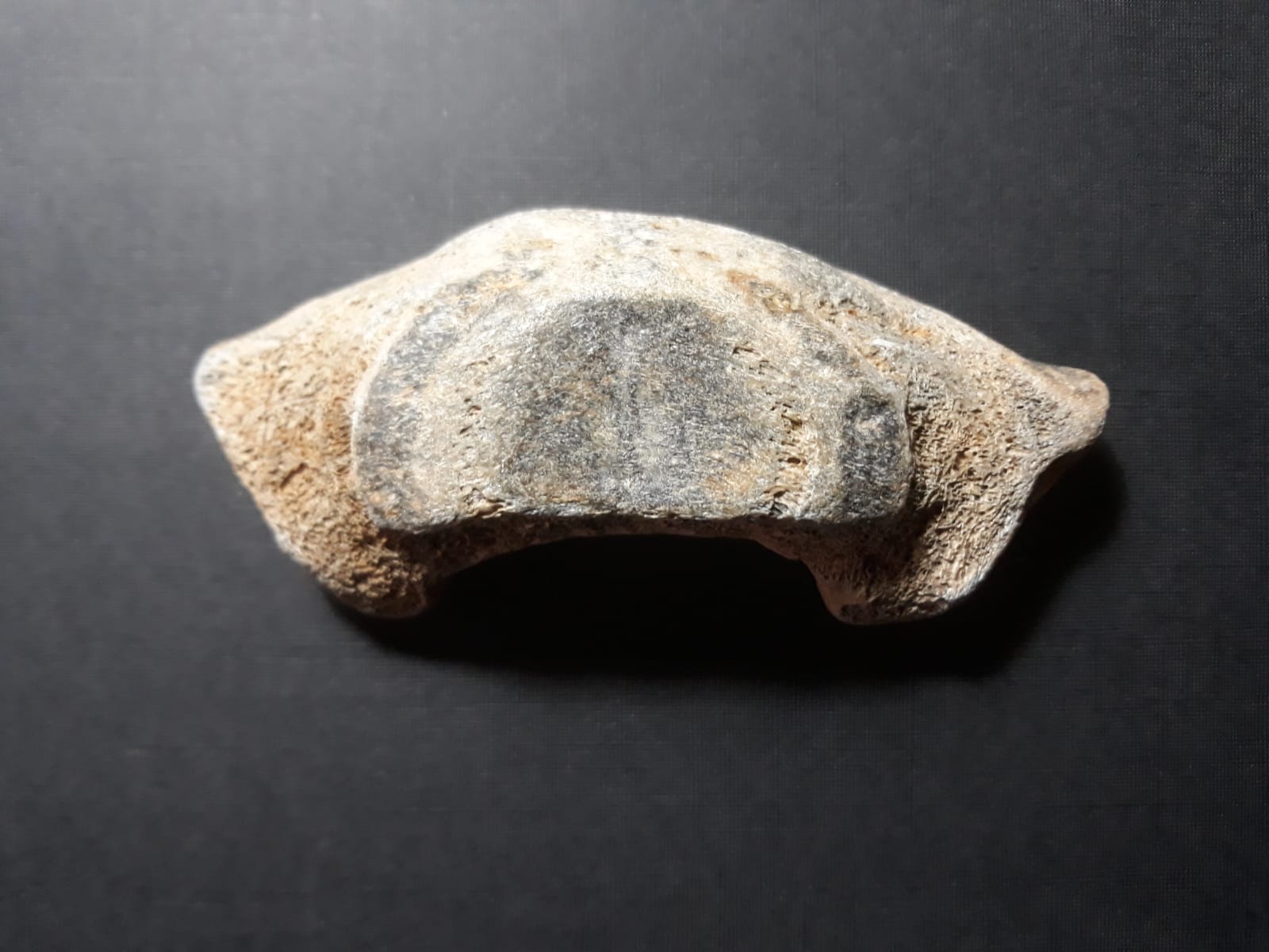 Vertebra?